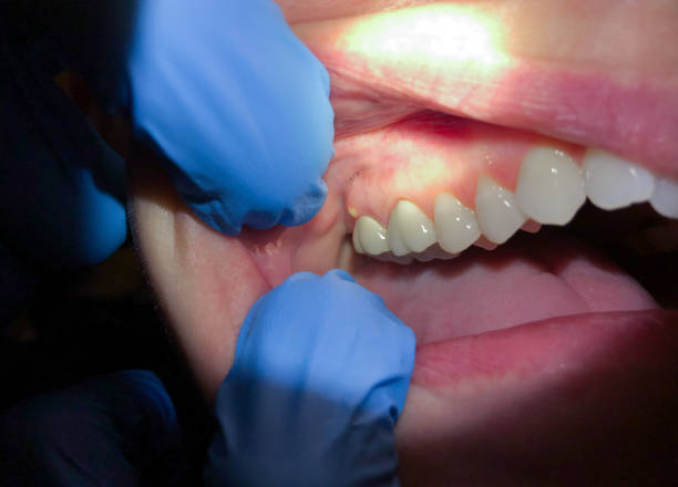 Best Emergency Dentist for Special Needs Patients in Sweet Home, OR