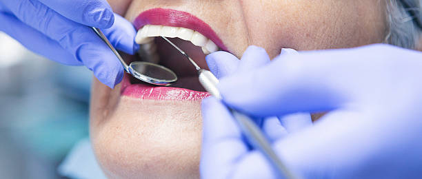 Best Broken or Cracked Tooth Emergency Dentist in Sweet Home, OR